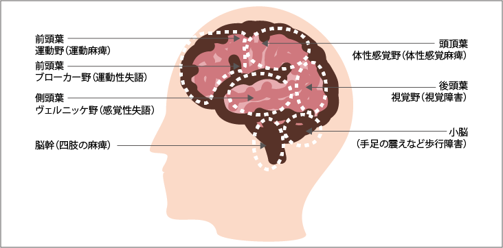 脳内解剖図