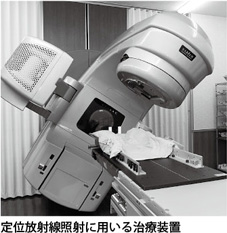 定位放射線照射に用いる治療装置