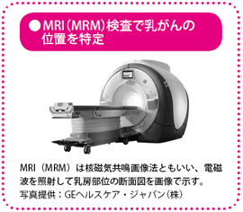 MRI（MRM）検査で乳がんの位置を特定