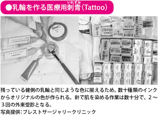 乳輪を作る医療用刺青（Tattoo）